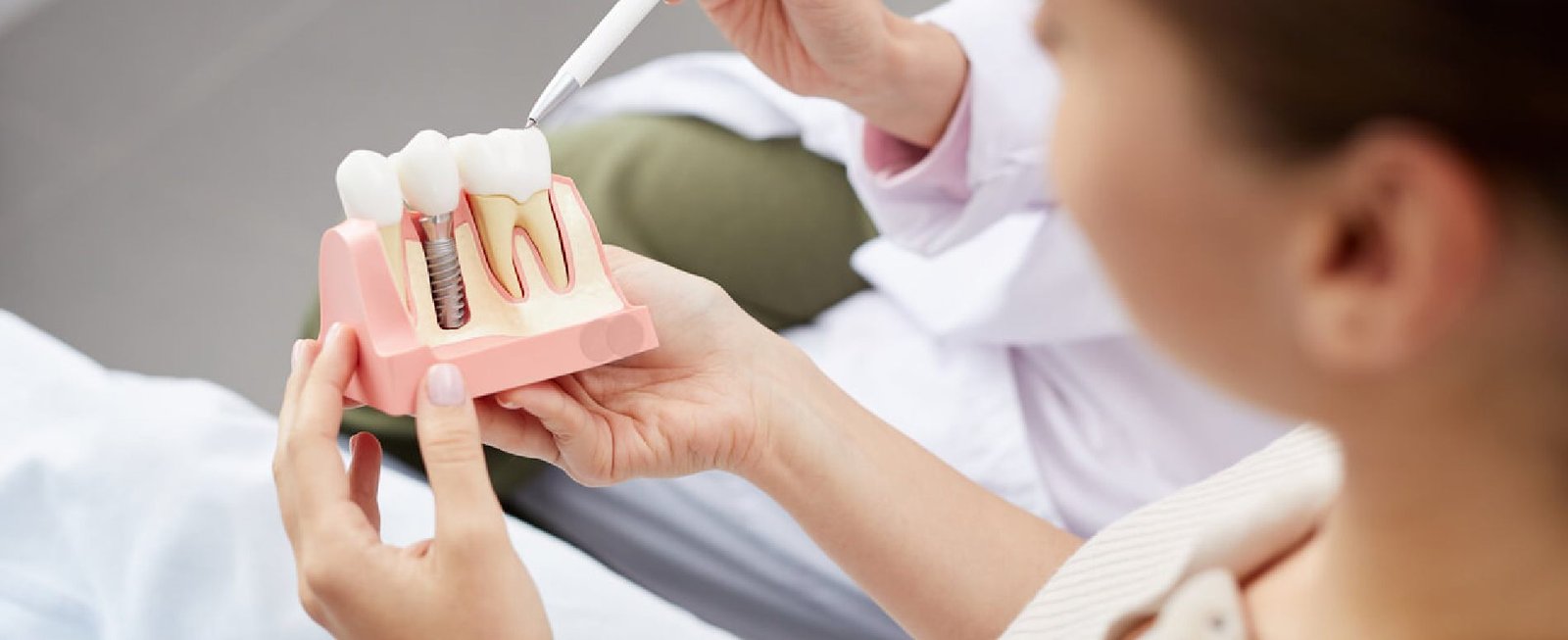 Dental Implants In Pune