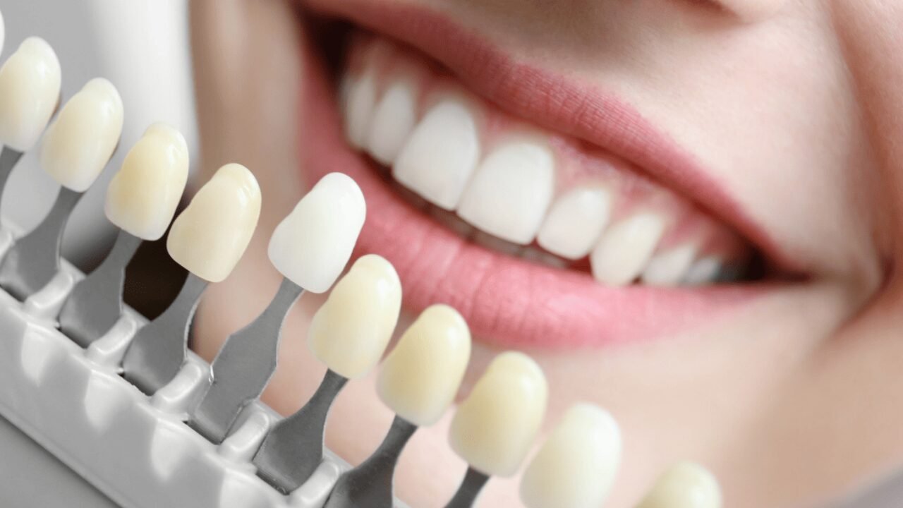 Cosmetic Dentistry in Erandwane