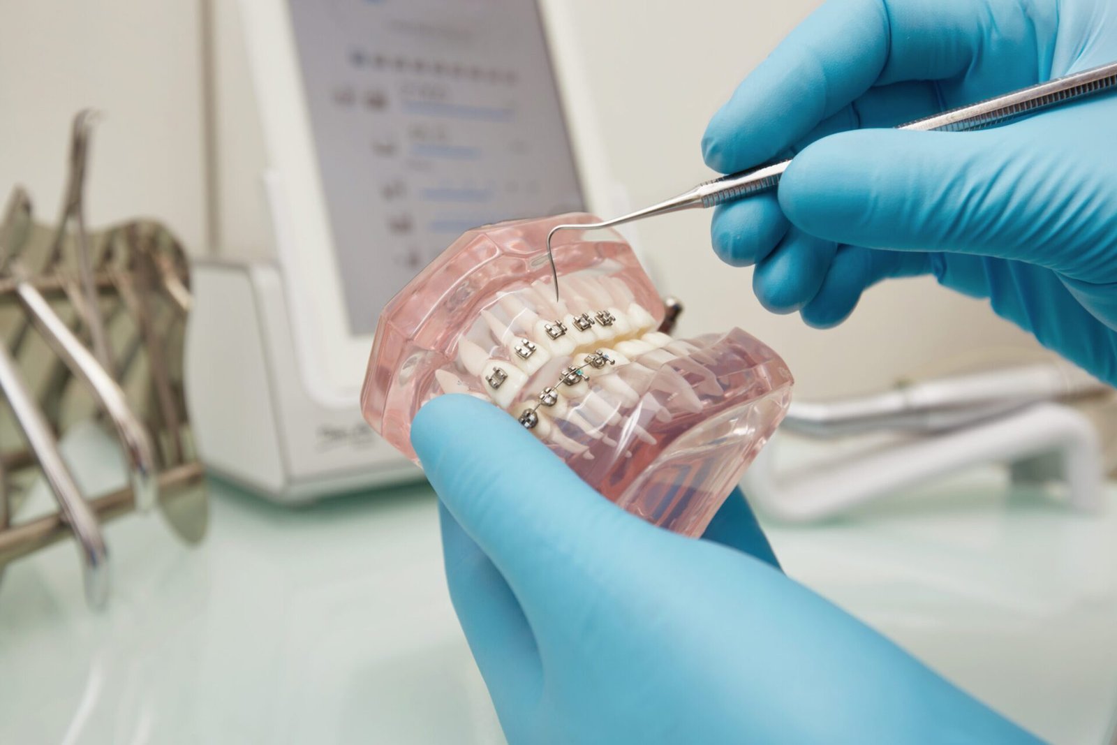 Invisalign Treatment in Kothrud Pune