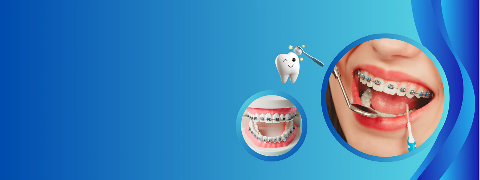 Transform Your Smile with Braces