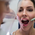 Dental implants before and after treatment at Soulful Dental Care Pune