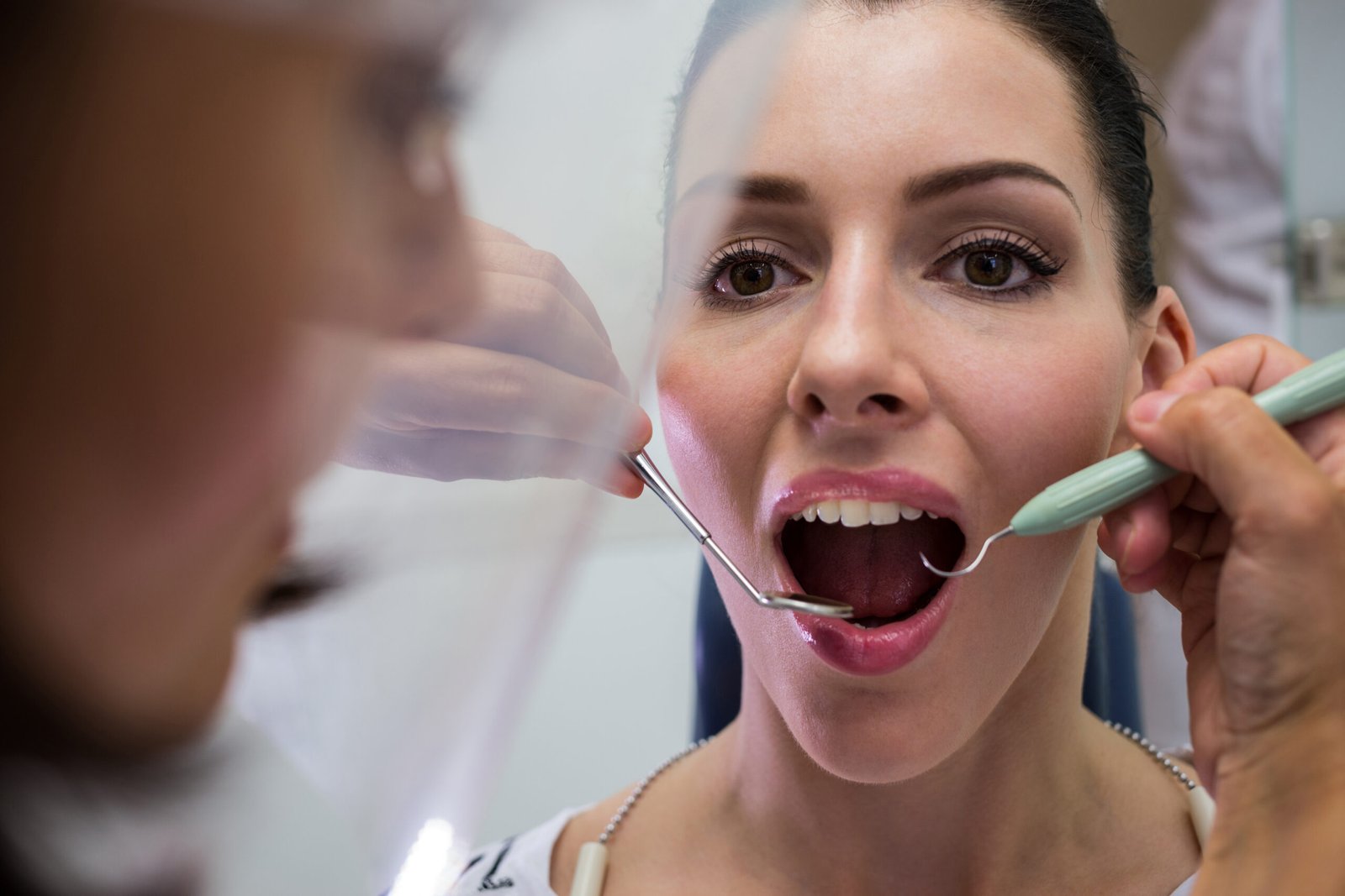 Dental implants before and after treatment at Soulful Dental Care Pune