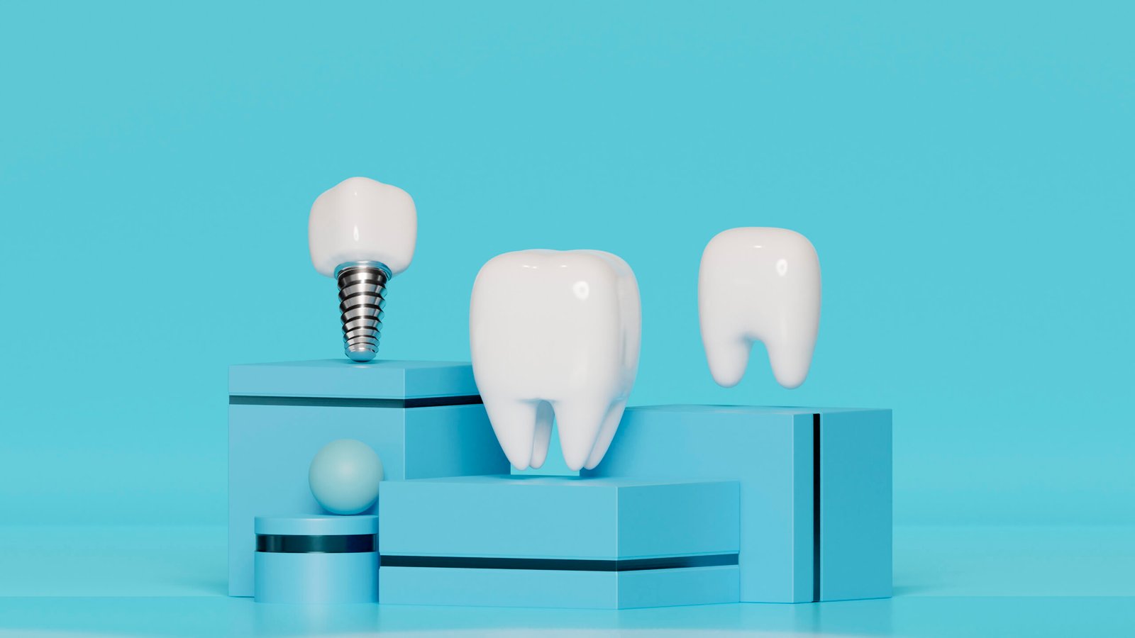 Find Best Dental Implants In Pune