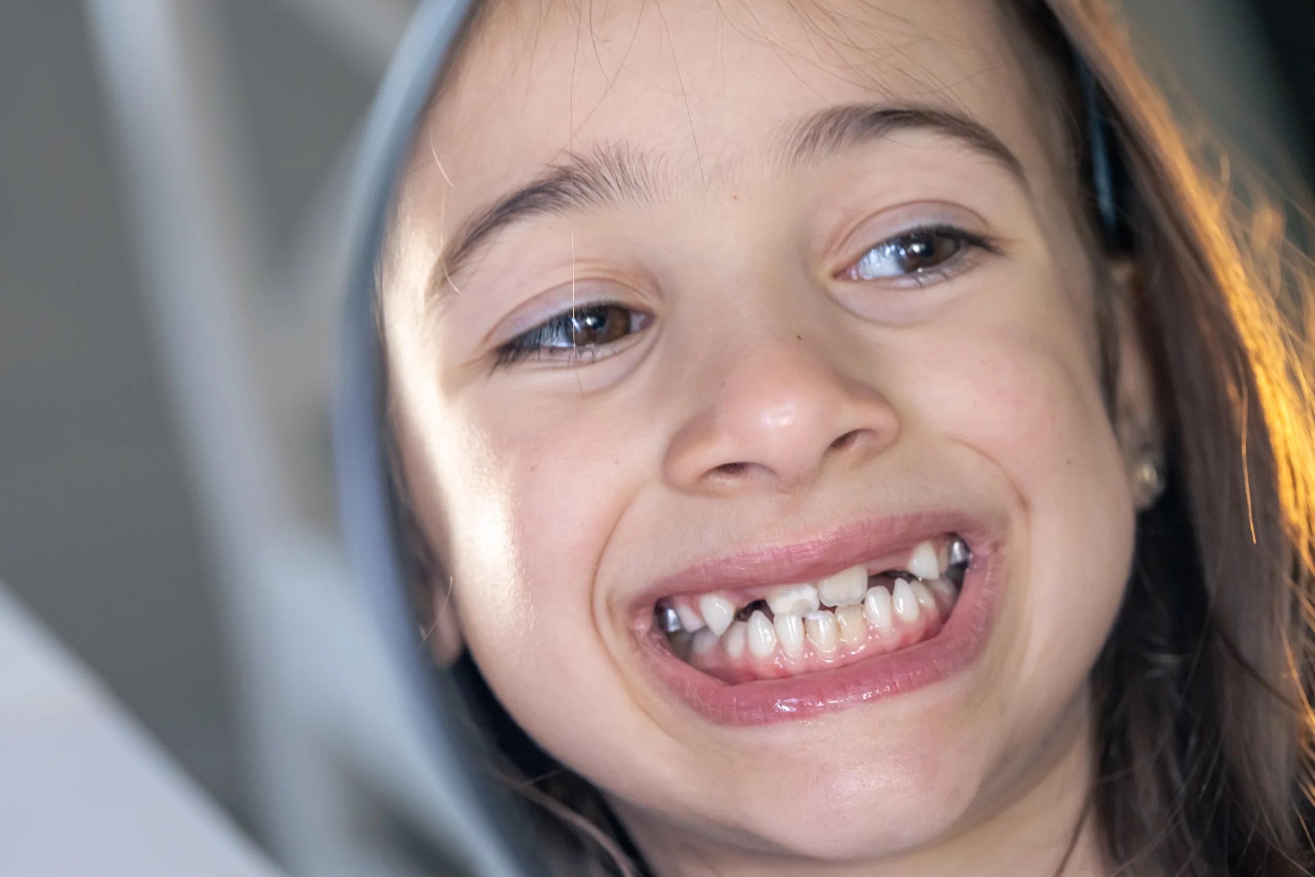 Find Insvisalign For Kids in Kothrud Pune