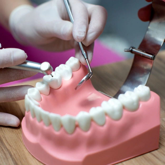 Dental Crowns & Bridges Treatment in Kothrud